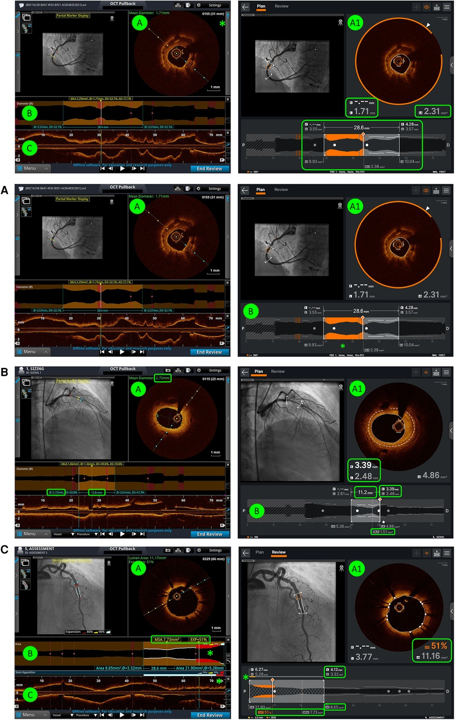 Here are a few options, keeping it under 13 words and in a news article style:

AI Enhances Doctors’ Eye Scan Interpretation, Eye Tracking Shows. (10 words)
Study: AI Improves Doctor Accuracy in Eye Scan Analysis. (9 words)
AI Boosts Physician OCT Interpretation, Eye Tracking Confirms. (9 words)
Eye Tracking Reveals AI Enhances Doctor Eye Scan Reading. (10 words)
AI Enhances Physician OCT Interpretation, Study Finds. (8 words)

Option 1 and 5 seem to be the most natural and news-article like while staying concise. Option 5 is the shortest and still conveys the core message effectively.